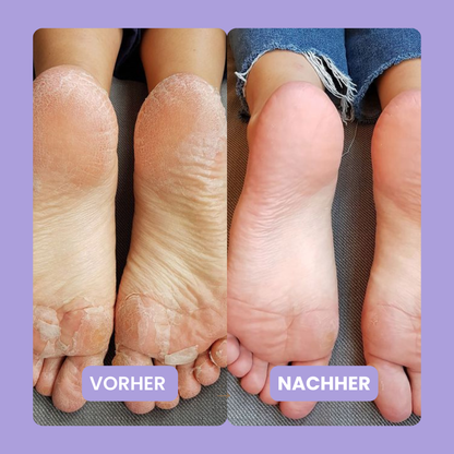 HornhautHero Plus – 2-in-1 Tool für Maniküre & Pediküre