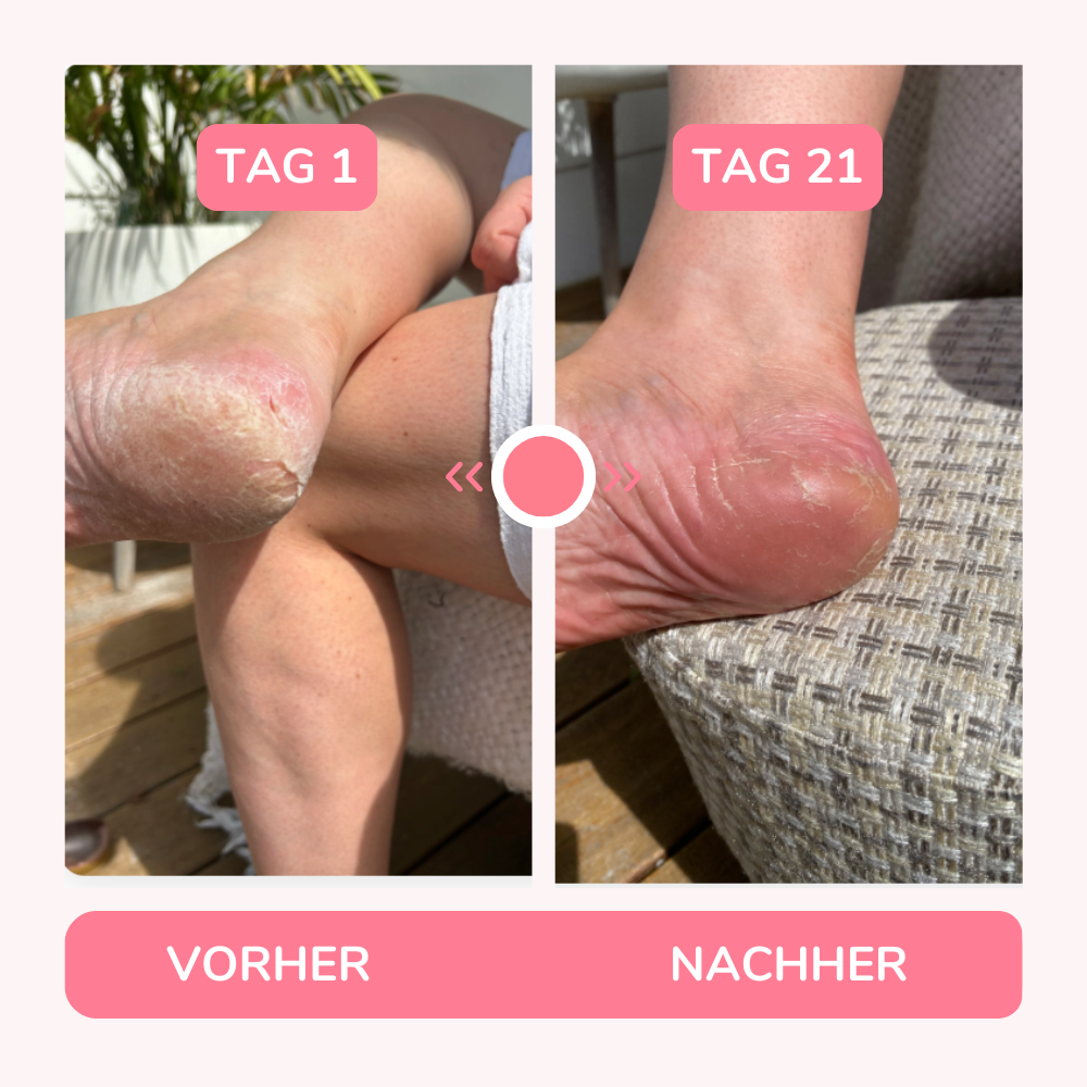 <p><strong>✨ TRÄUME WERDEN WAHR✨</strong></p>