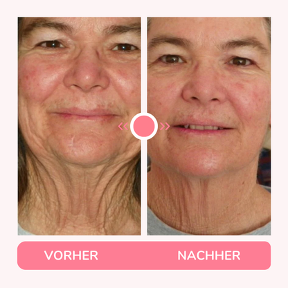 NeckLift Pro – Sofort straffer Hals ohne OP
