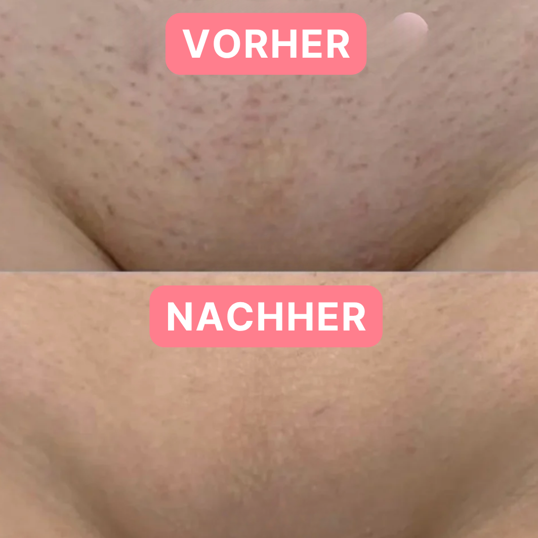 Velvéra Intimrasierer