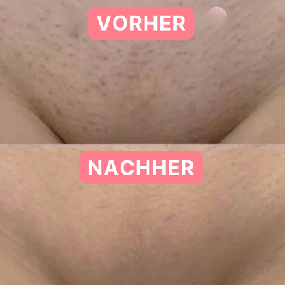 Velvéra Intimrasierer