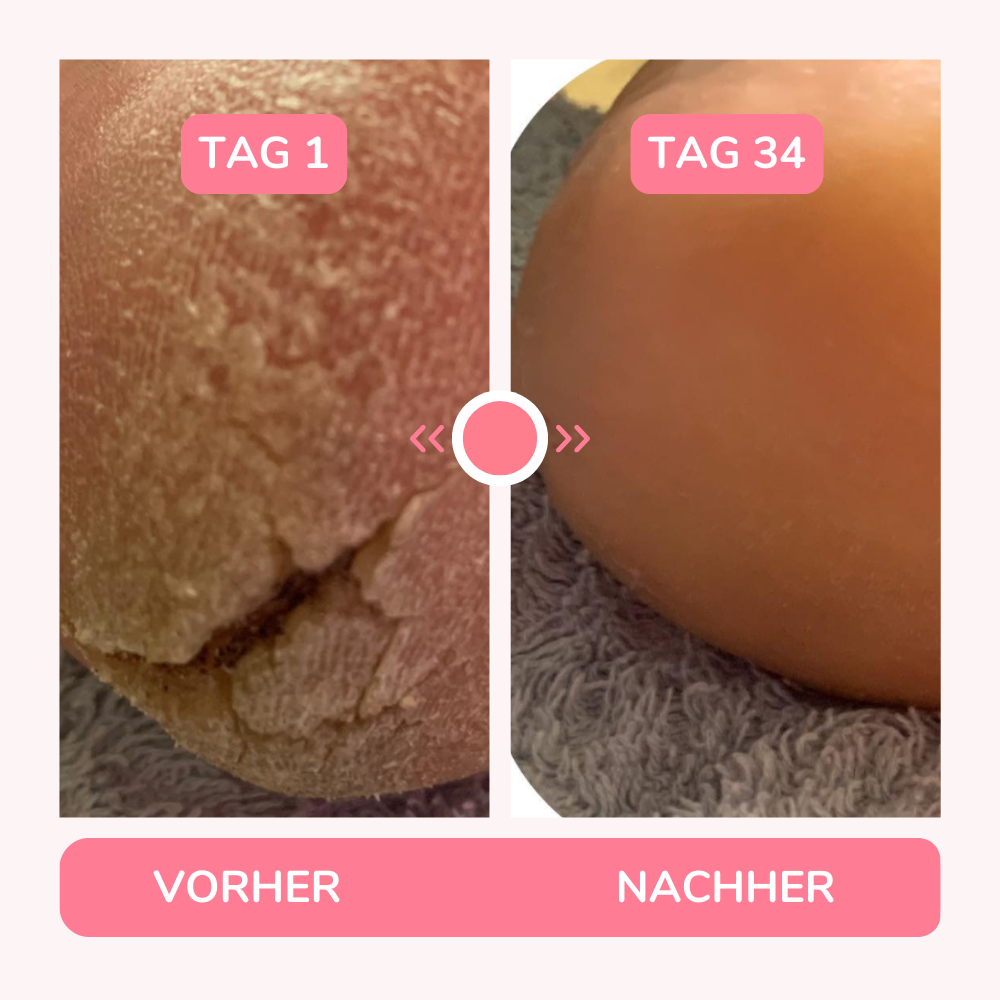 <p><strong>✨ TRÄUME WERDEN WAHR✨</strong></p>