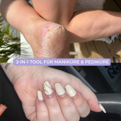 HornhautHero Plus – 2-in-1 Tool für Maniküre & Pediküre